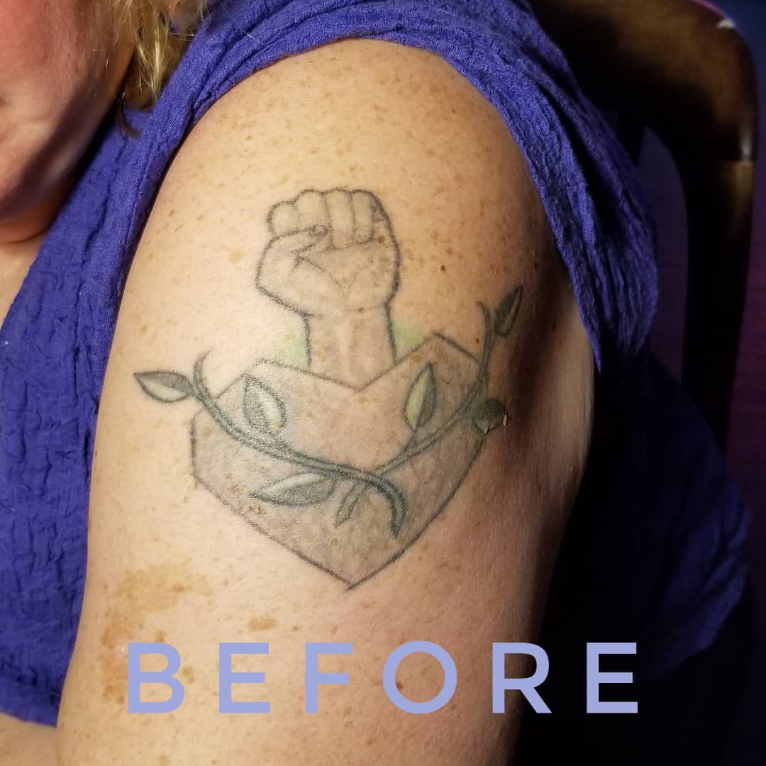 LGBTQ%20tattoo%20before